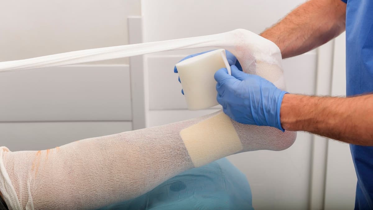 Profissional de saúde aplicando curativo na perna de um paciente durante o cuidado pós-operatório